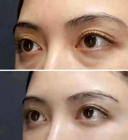 Collagen Anti-Wrinkle Eye Bag Cream